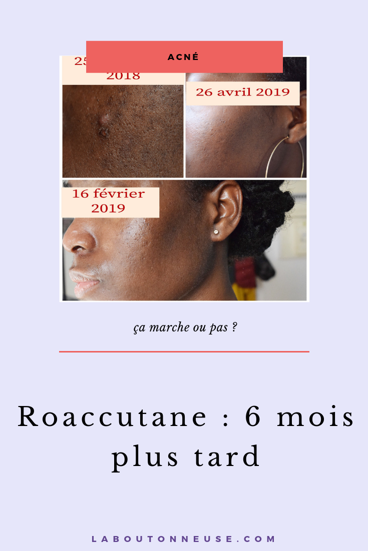 Roaccutane achat en ligne