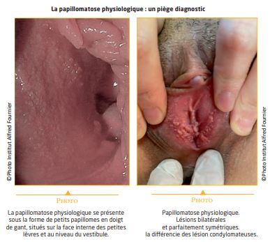 Aldara crème 5 prix