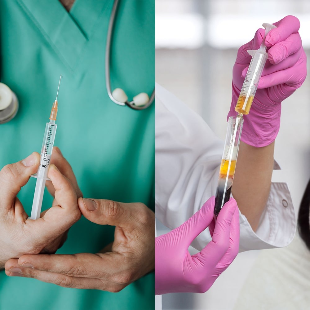 Coût Du Prednisolone