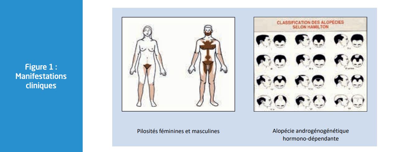 Finasteride pilules