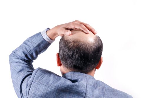 Finasteride le prix