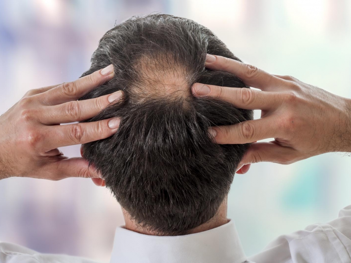 Finasteride 1 mg prix