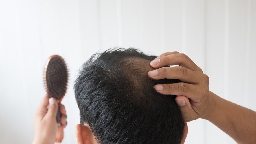 Finasteride en france
