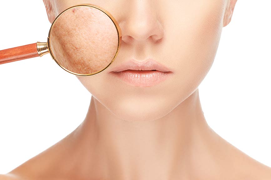 Acheter du isotretinoin générique
