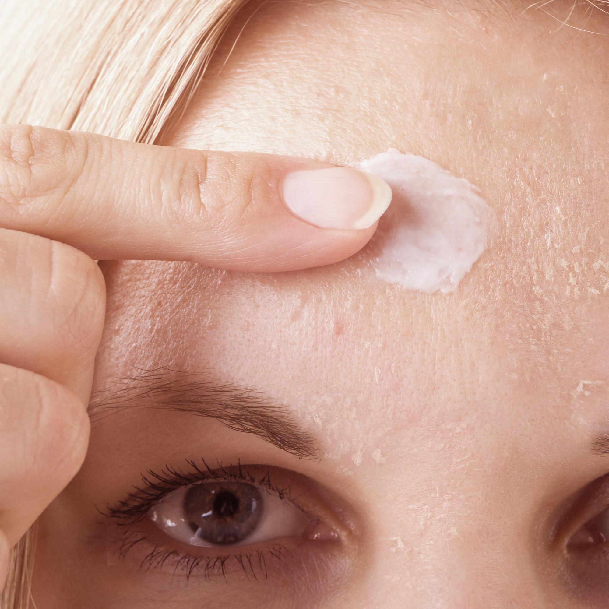Achat Accutane En Ligne