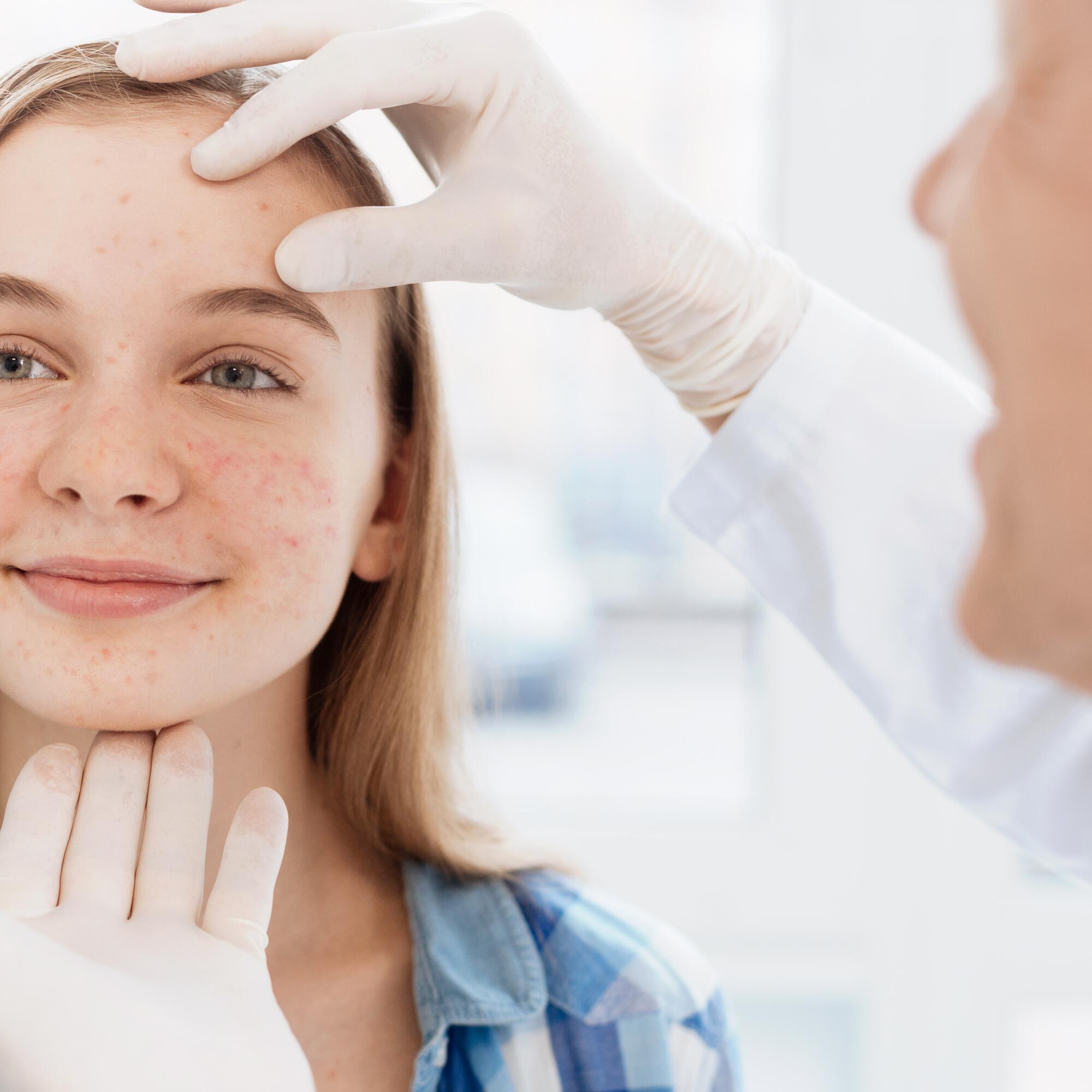où acheter du accutane