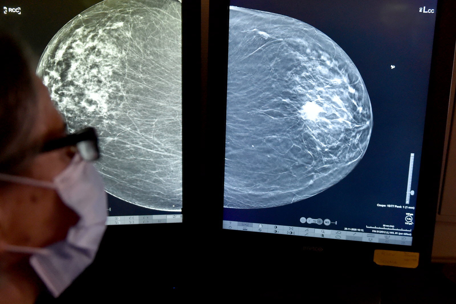 Commander du tamoxifen en ligne
