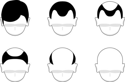 Acheter du finasteride