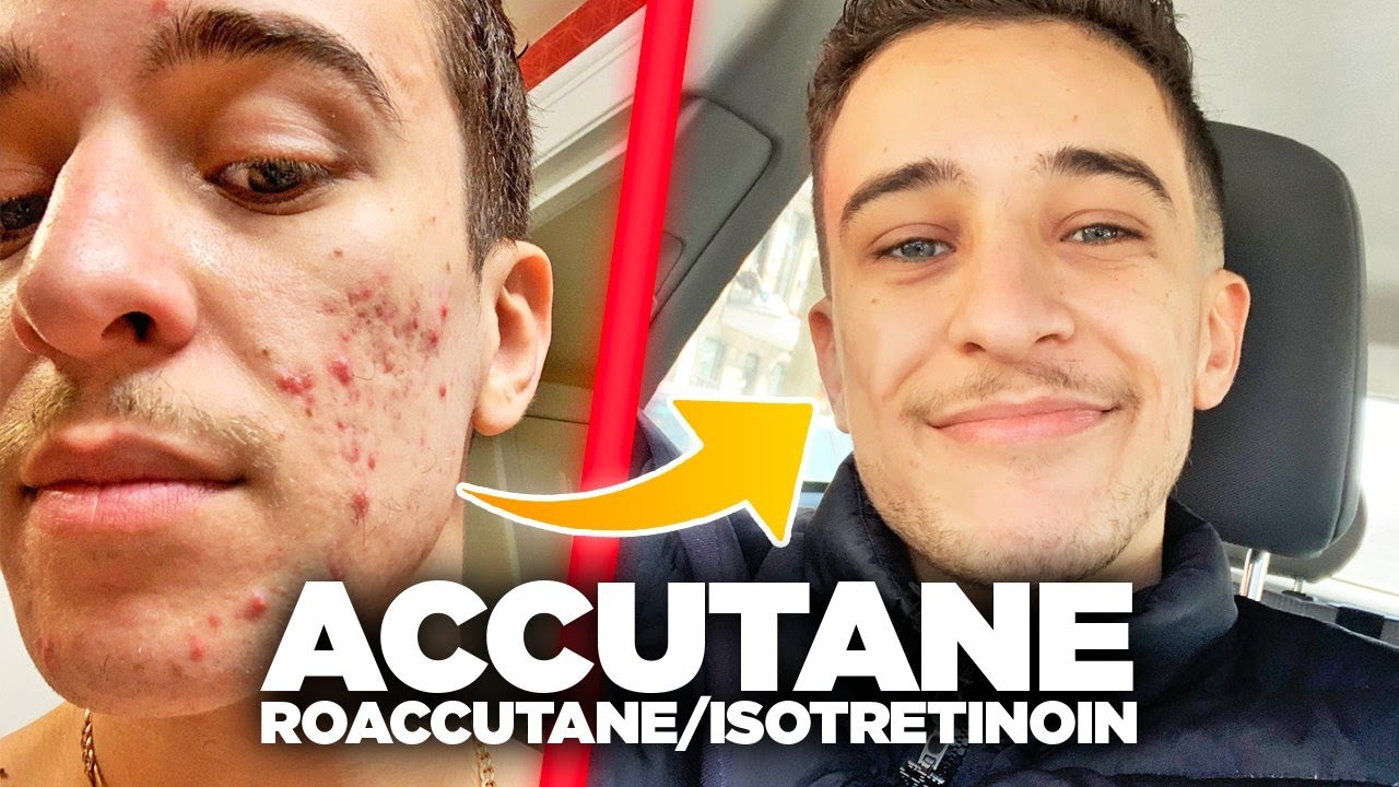 Acheter Isotrex Générique