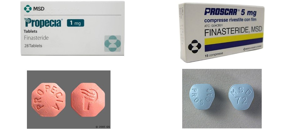 Le Prix Finasteride