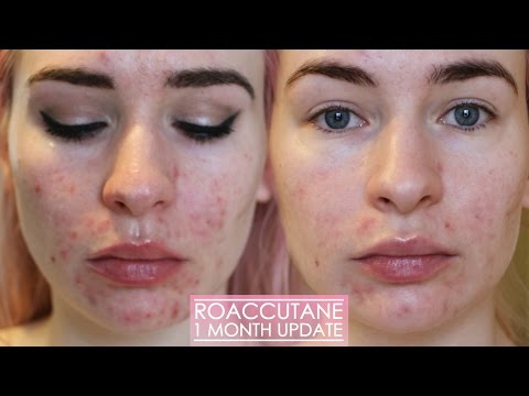Accutane 30mg