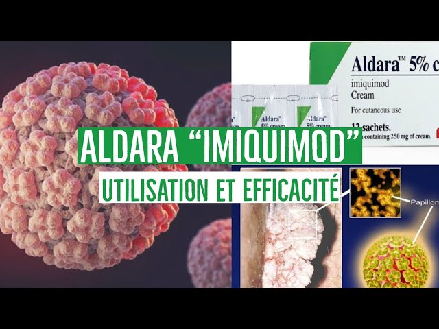 Prix medicament aldara