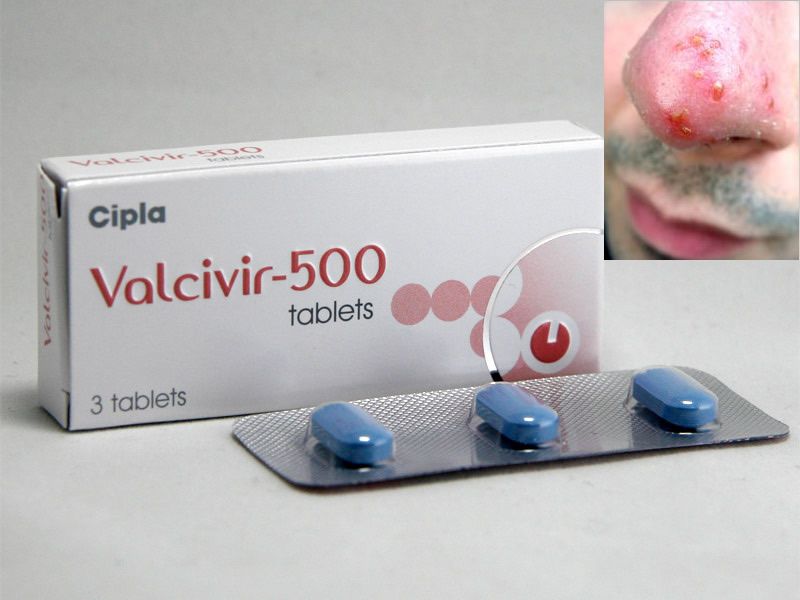 Valacyclovir 1000mg online